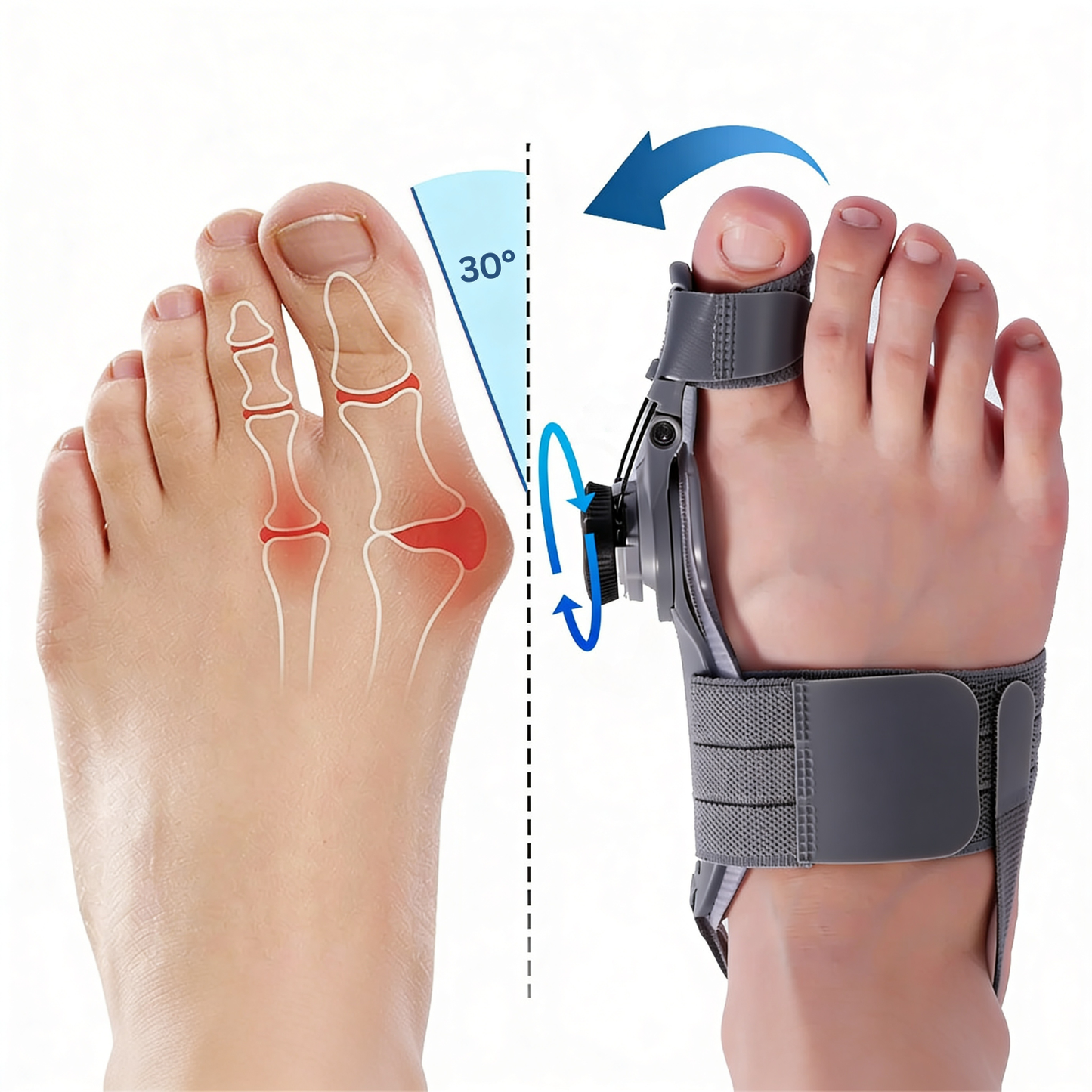 Bunion Pain Getting Worse? Ease daily pressure and support better toe alignment — without going under the knife.