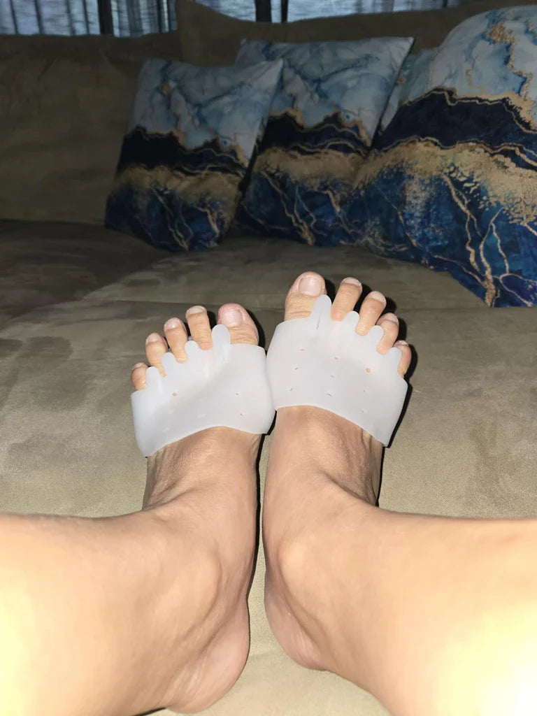Week 2: toes look straighter and shoes stop rubbing